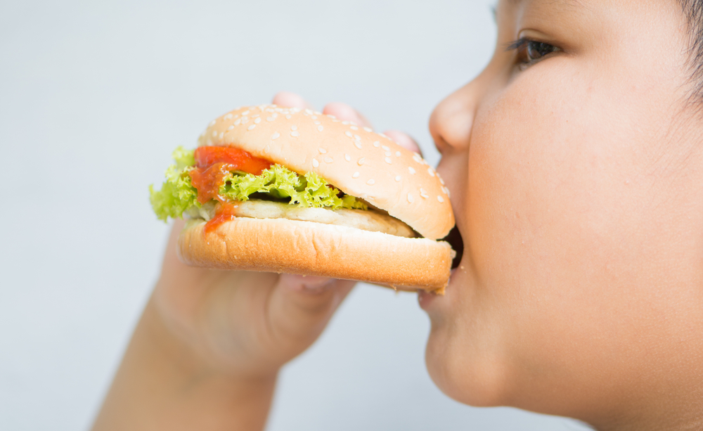 Obesitas di Usia Pre-School